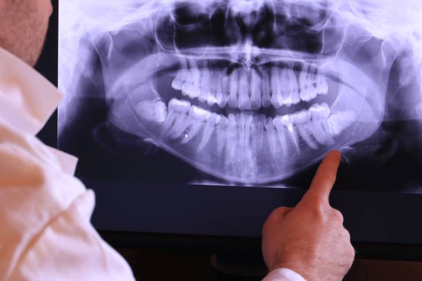 Best Emergency Dental Extractions in Chariton, IA